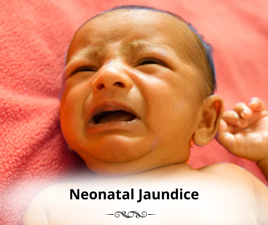 Neonatal Jaundice